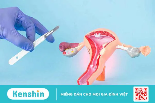 Vô sinh ở nữ có chữa được không? Cách điều trị vô sinh nữ hiện nay là gì?