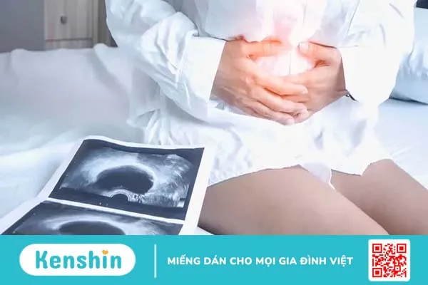 Vỡ u nang buồng trứng có nguy hiểm không? Xử trí và phòng ngừa ra sao?