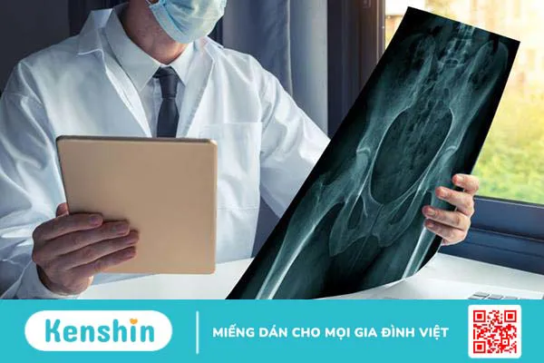 Xạ hình xương là gì ? quy trình thực hiện chụp xạ hình xương