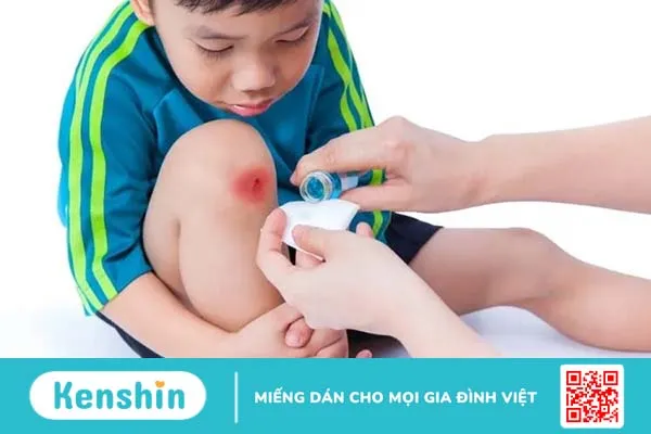 Xà phòng castile: Sản phẩm kỳ diệu khi làm sạch và làm đẹp