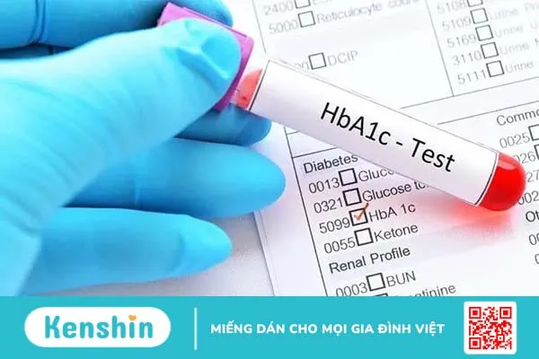 Xét nghiệm A1C theo dõi bệnh tiểu đường