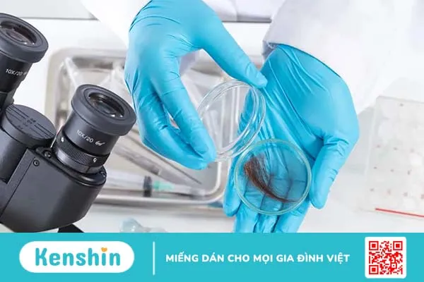 Xét nghiệm ADN bằng tóc và những điều bạn cần biết