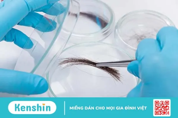 Xét nghiệm ADN bằng tóc và những điều bạn cần biết