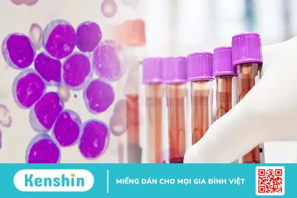 Xét nghiệm CA-125 chẩn đoán bệnh ung thư buồng trứng