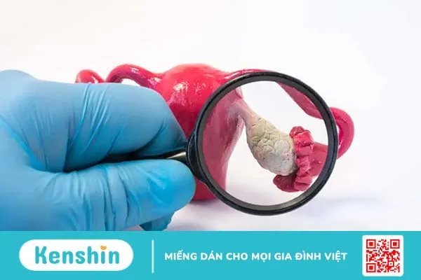 Xét nghiệm CA-125 chẩn đoán bệnh ung thư buồng trứng