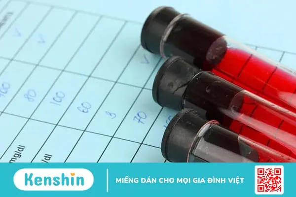 Xét nghiệm chẩn đoán xơ gan gồm bao nhiêu phương pháp?