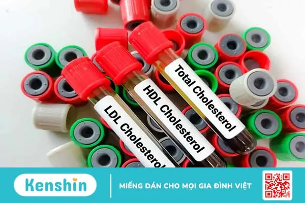 Xét nghiệm định lượng cholesterol toàn phần