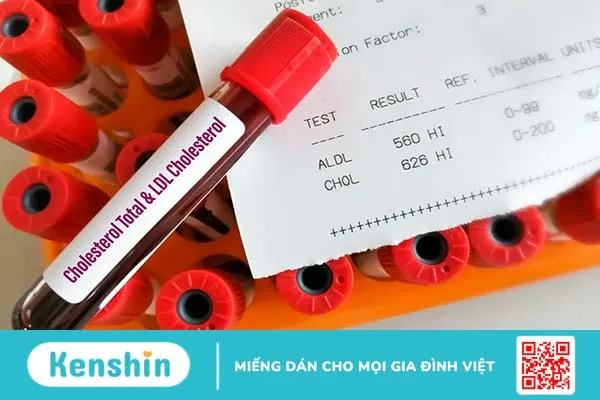 Xét nghiệm định lượng cholesterol toàn phần