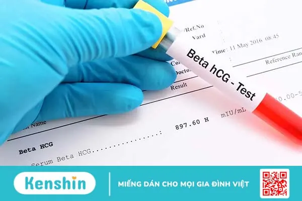 Xét nghiệm Double test là gì? Khi nào thực hiện và quy trình ra sao?