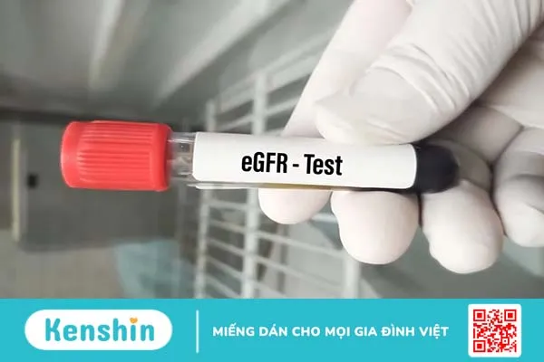 Xét nghiệm eGFR là gì? Hiểu để nắm rõ tình trạng thận của mình