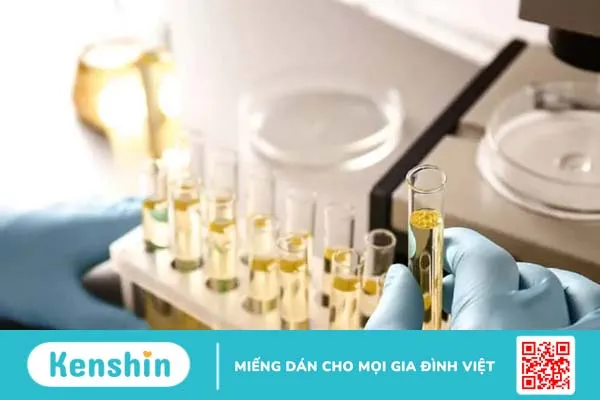 Xét nghiệm glucose nước tiểu