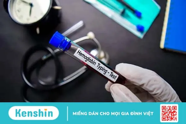 Xét nghiệm HbA1c