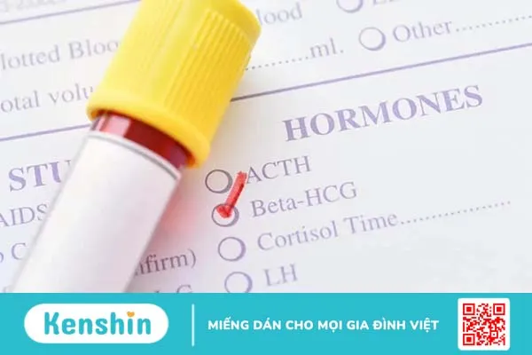 Xét nghiệm hCG