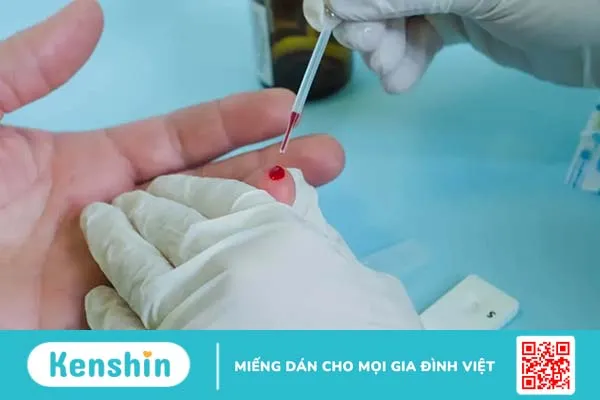 Xét nghiệm HIV AB Test nhanh có chính xác không?