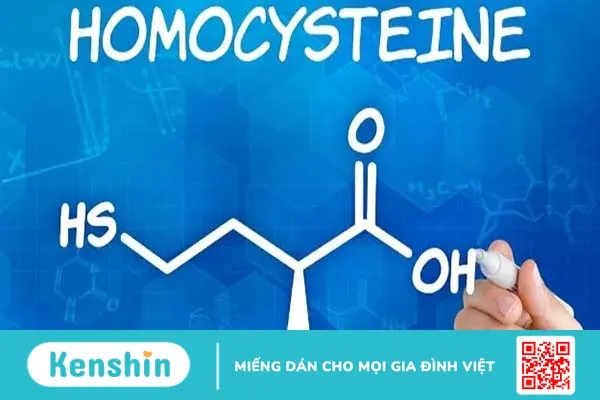 Xét nghiệm homocysteine