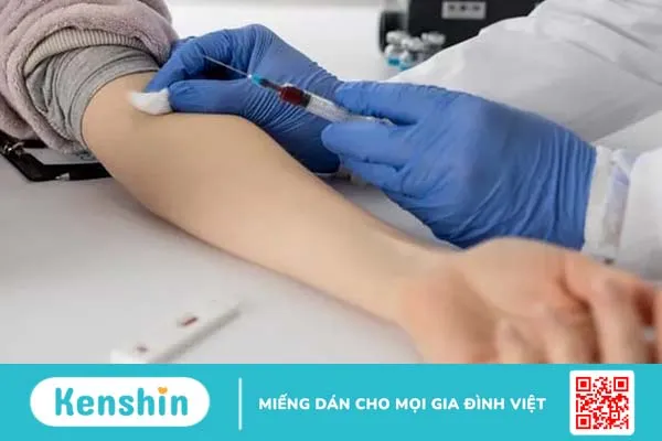 Xét nghiệm homocysteine