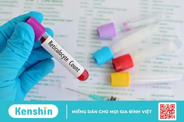 Xét nghiệm hồng cầu lưới