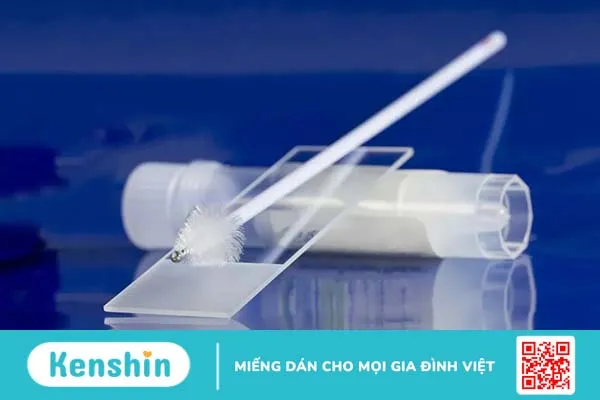 Xét nghiệm HPV dương tính có phải ung thư? Cần làm gì sau đó?