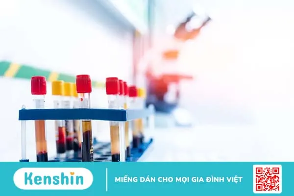 Xét nghiệm HPV dương tính có phải ung thư? Cần làm gì sau đó?