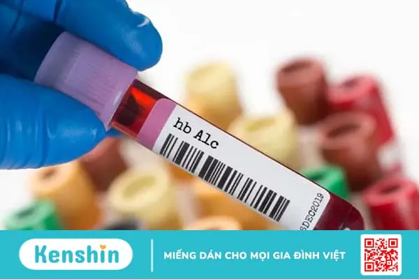 Xét nghiệm huyết sắc tố A1C kiểm tra bệnh tiểu đường