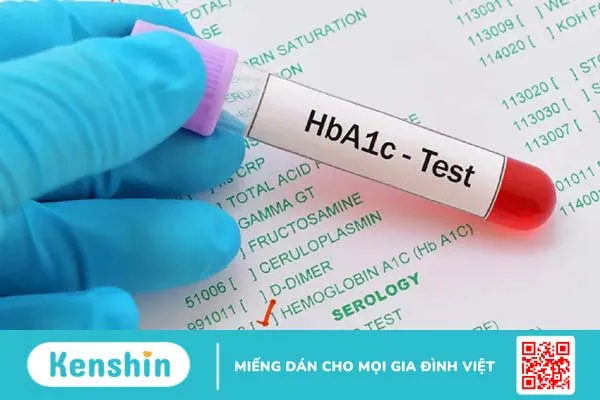 Xét nghiệm huyết sắc tố A1C kiểm tra bệnh tiểu đường