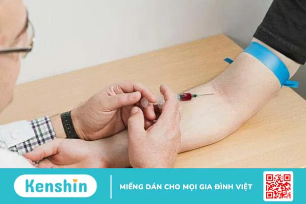 Xét nghiệm khí CO trong máu