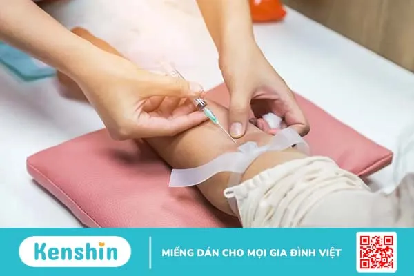 Xét nghiệm LH để làm gì? – Hướng dẫn đọc kết quả