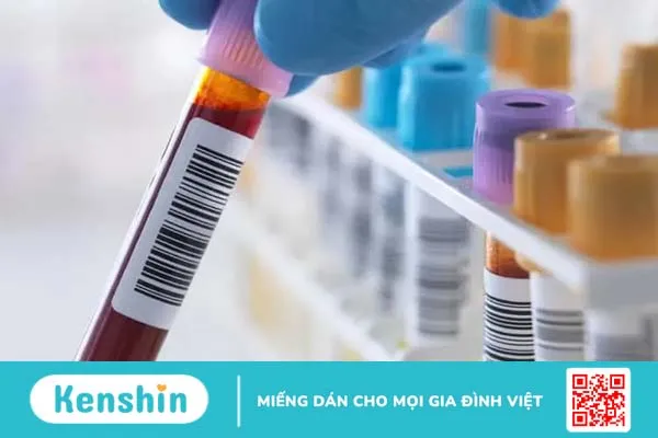 Xét nghiệm lipase