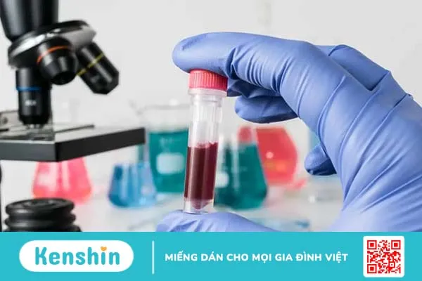 Xét nghiệm máu có phát hiện ung thư không?