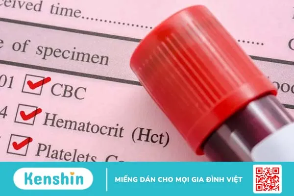 Xét nghiệm máu là gì? Các loại xét nghiệm máu?