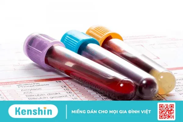 Xét nghiệm myoglobin để chẩn đoán vấn đề về cơ tim