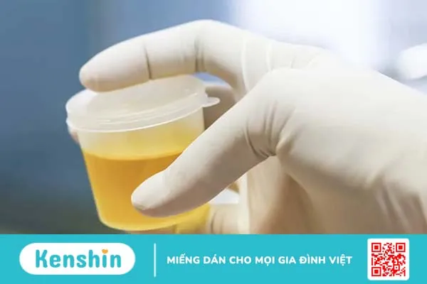 Xét nghiệm nhiễm trùng tiểu tại nhà