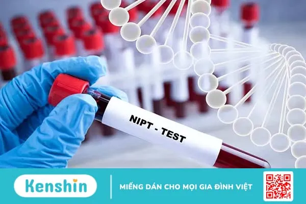 Xét nghiệm NIPT biết được những gì, giúp phát hiện bệnh gì?