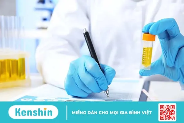 Xét nghiệm nước tiểu trong bệnh tiểu đường