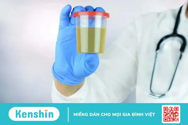 Xét nghiệm nước tiểu và những điều quan trọng bạn cần biết