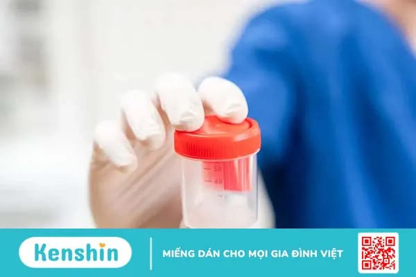 Xét nghiệm tinh dịch đồ: Những điều nam giới cần biết!