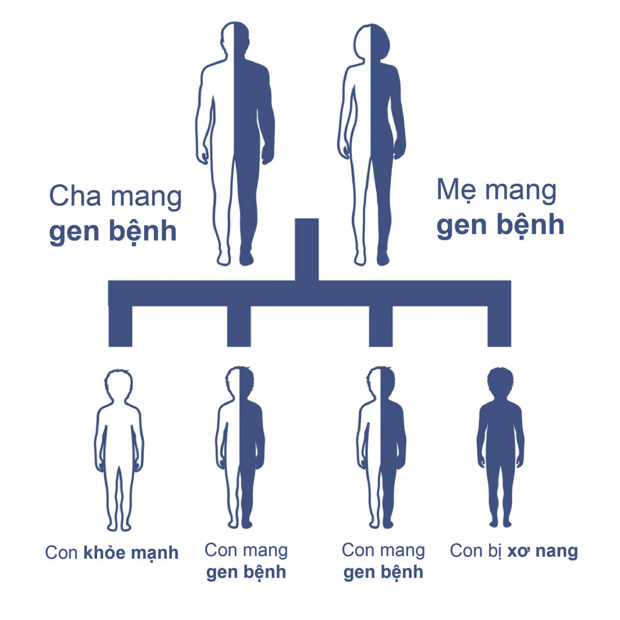 Xơ nang ở trẻ nhỏ: Căn bệnh di truyền nguy hiểm mà cha mẹ cần lưu ý