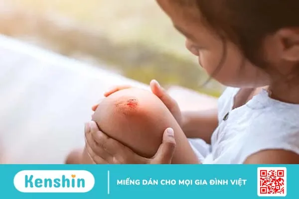 Xử lí vết thương bị nhiễm trùng đúng cách