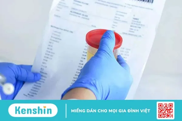 Xuất hiện nước tiểu màu cam có đáng lo ngại? Nguyên nhân & Cách điều trị