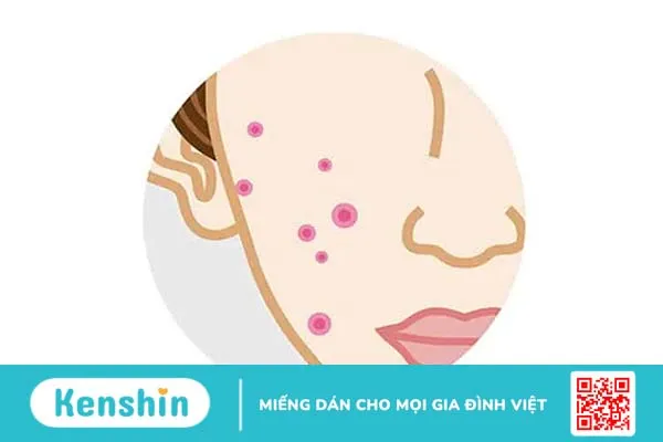 5 lợi ích kem dưỡng ẩm giúp da bạn luôn mịn màng