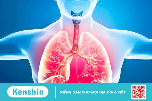 Bạn biết gì về tăng áp động mạch phổi?