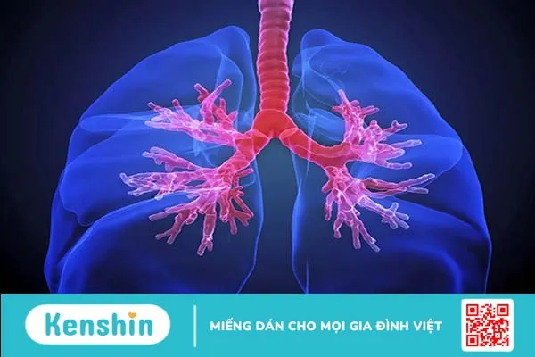 Bạn biết gì về tăng áp động mạch phổi?