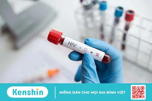 Bệnh HIV có chữa được không? Những điều cần biết khi nhiễm HIV