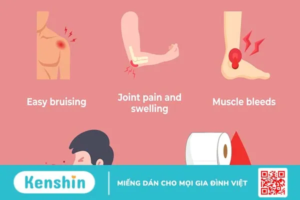 Bệnh máu khó đông (Rối loạn đông máu di truyền)