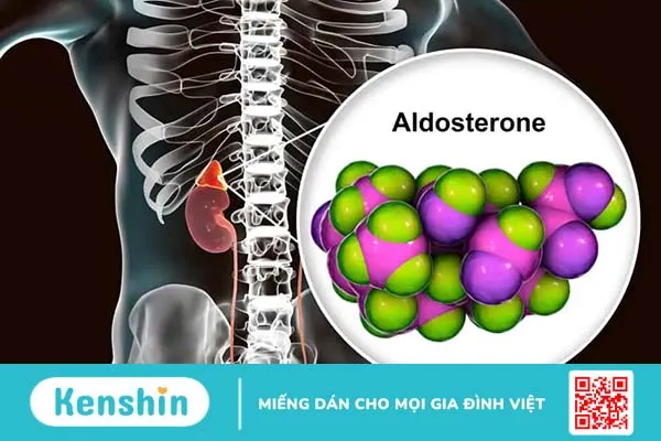 Cường aldosterone