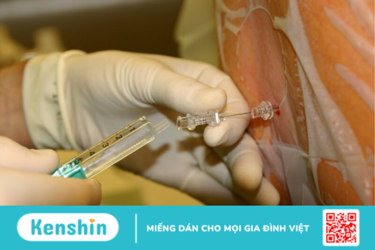 Gây mê liệu có ảnh hưởng đến thai nhi và quá trình sinh nở?