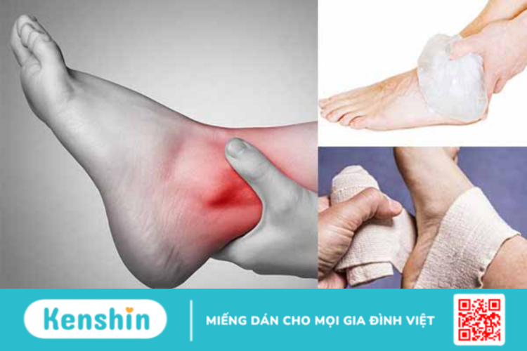 Hướng dẫn sơ cứu và điều trị trật mắt cá chân tại nhà