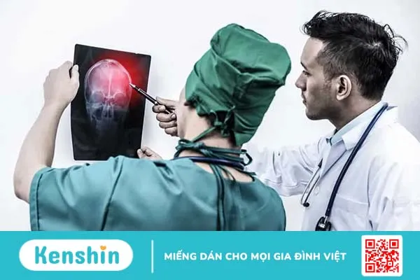 Nấc cục kéo dài có thể là dấu hiệu của hội chứng hành tủy bên