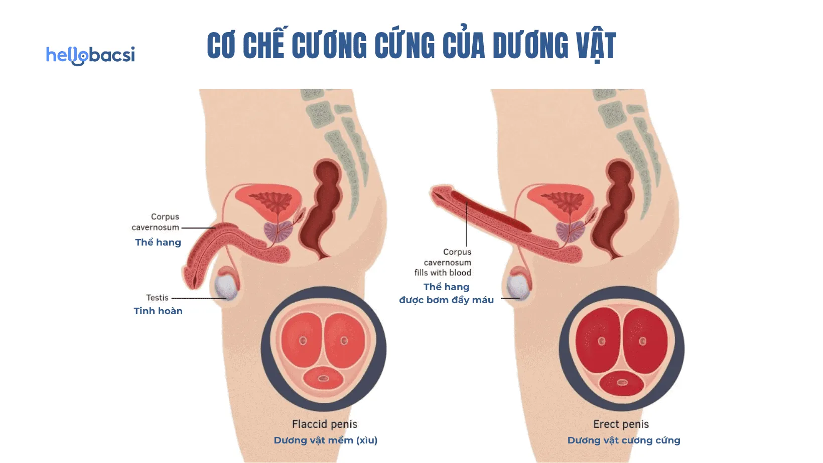 Nên để cậu nhỏ hướng lên hay xuống khi mặc quần lót?