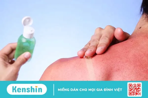 Nha đam (lô hội): 10 công dụng khỏe đẹp toàn diện